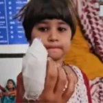 baby-girl-s-finger-cut