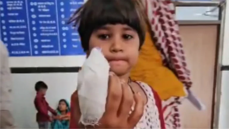 baby-girl-s-finger-cut